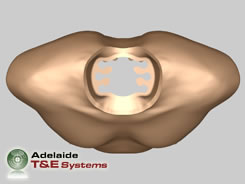 HTS Outer Skin/Soft Tissue Assembly