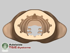 HTS Outer Skin/Soft Tissue Assembly