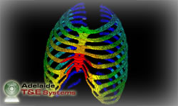 Finite Element Analysis