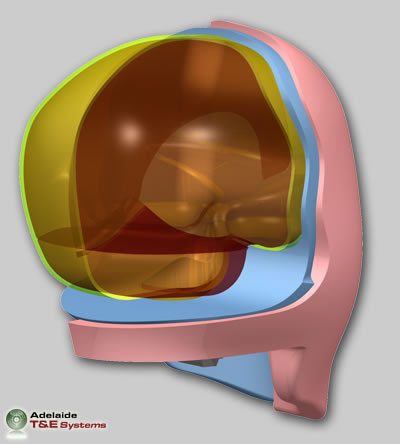 Frangible Ballistic Head (FBH)