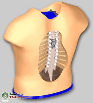 Human Thoracic Surrogate (HTS)